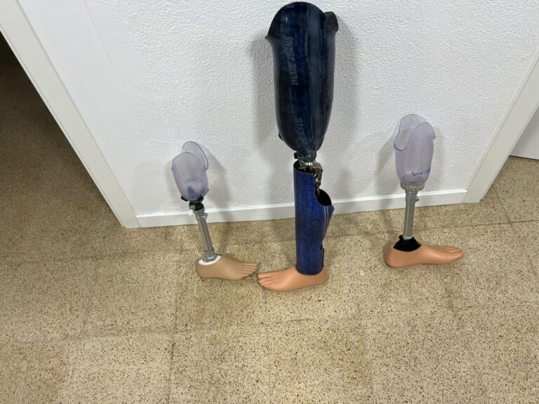 protesis-personalizadas-pierna-tibial